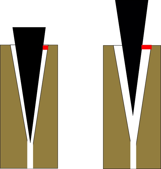 nadel.jpg